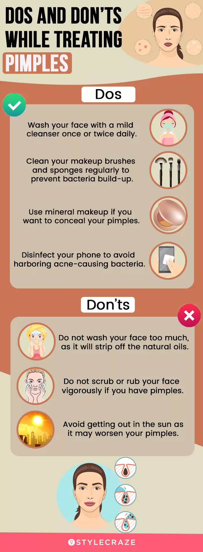 Fast & Effective: Quick Easy Ways to Get Rid of Pimples